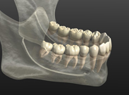 歯科用CTの全国導入率